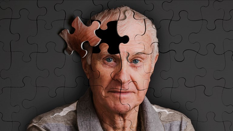 El Alzheimer y la demencia, las grandes lacras del siglo XXI.